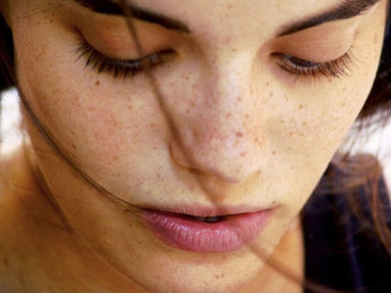 Say Goodbye to Freckles with Home Remedies