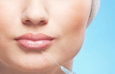 Lip augmentation